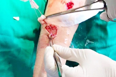 Sang nhà hàng xóm chơi, cụ bà 79 tuổi bị cặp chó béc-giê tấn công với hàng chục vết thương