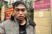 Shipper đòi tài xế Lexus bồi thường hơn 1 tỷ: Pháp luật quy định ra sao?