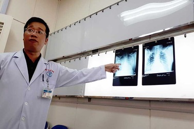 Thực hư vi rút lạ tấn công đạo diễn VTV