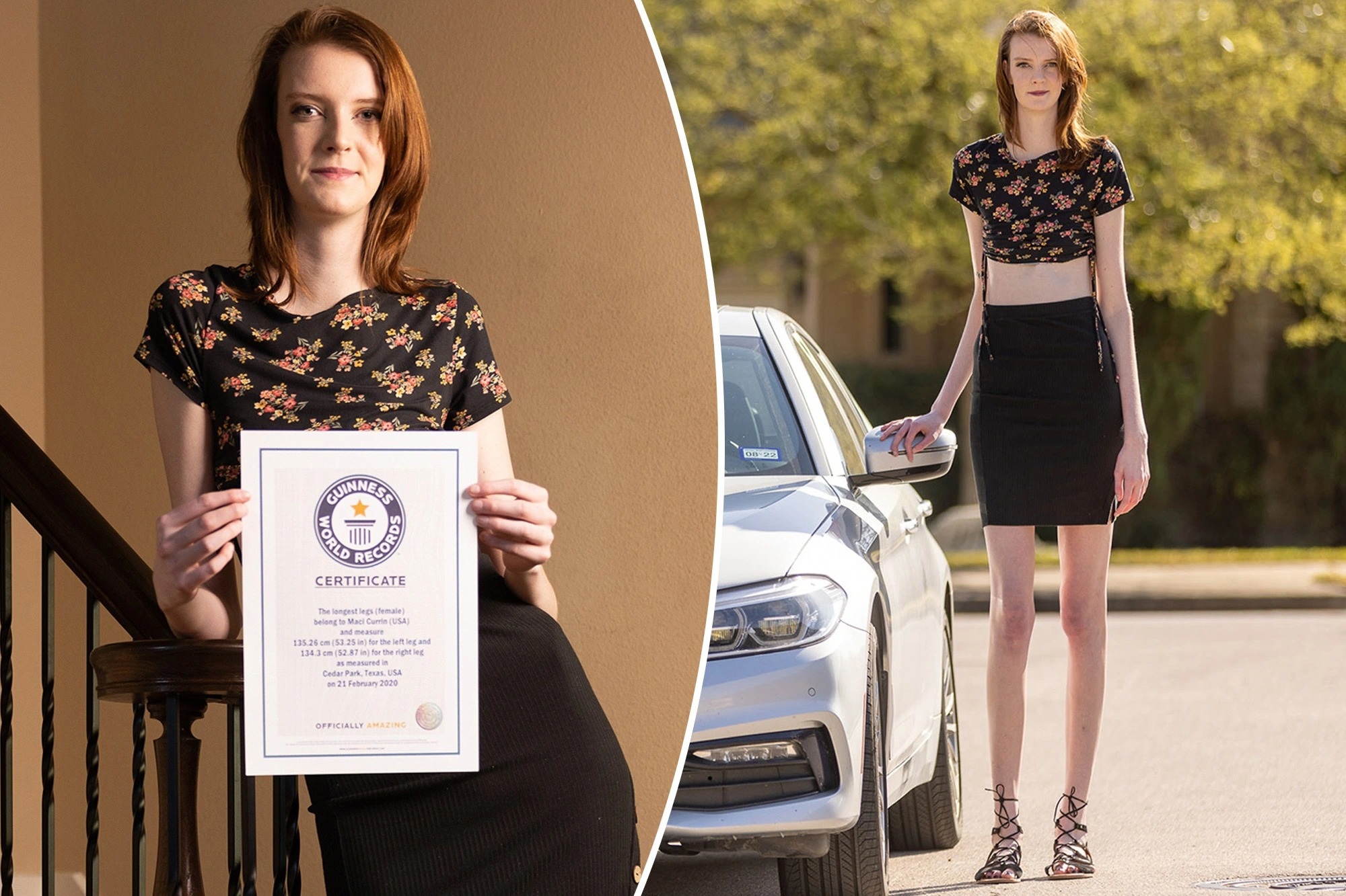 Cô gái chân dài nhất thế giới muốn chứng minh rằng mình... quyến rũ - 1