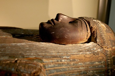 Người cổ đại cũng mắc bệnh xơ vữa động mạch