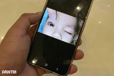 Bé 2 tuổi bị pháo hoa bắn trúng mắt khi xem Trung thu