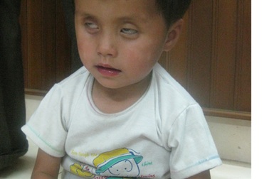 Tương lại mịt mờ của hai chị em bị mù bẩm sinh 