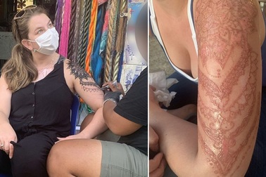 Vết xăm kỷ niệm thành nỗi kinh hoàng