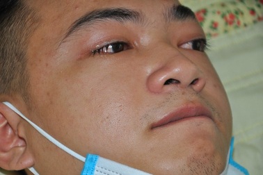 Bạn đọc Dân trí giúp em Đức được ghép thận thành công