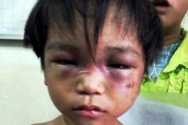 Cháu bé 3 tuổi bị bạo hành được mẹ đưa đi trốn?