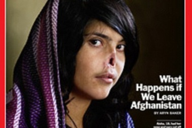 Cô gái không mũi trên tạp chí Time và số phận phụ nữ Afghanistan