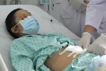 TPHCM: Ăn cá rô phi, người phụ nữ bị thủng động mạch nguy kịch