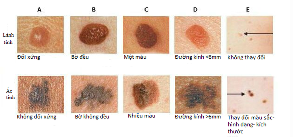 17 triệu chứng sớm cảnh báo ung thư nam giới nhất định phải biết - 1