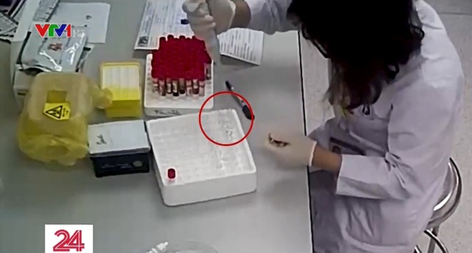 Hàng nghìn que thử HIV, viêm gan B bị cắt đôi trước khi tiến hành xét nghiệm - 4 Hàng nghìn que thử HIV, viêm gan B bị cắt đôi trước khi tiến hành xét nghiệm - 4