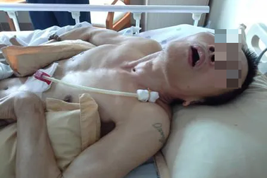 Người bệnh gặp sự cố y khoa, cơ sở y tế không thể vô can