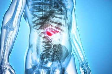 Những dấu hiệu sớm của ung thư tụy