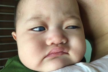 Mắc bệnh hiếm gặp, bé 1 tuổi nguy cơ mù vĩnh viễn vì... không đủ tiền phẫu thuật