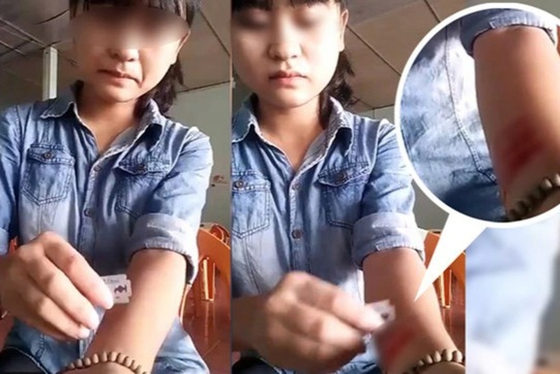 Cứu giúp người trẻ mắc chứng tự ngược đãi chỉ bằng một cái ôm - 1 Cứu giúp người trẻ mắc chứng tự ngược đãi chỉ bằng một cái ôm - 1