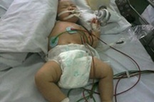 Ngộ độc thuốc nhỏ mũi, bé 3 tháng tuổi nhập viện