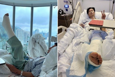 Sao "Diệp Vấn" gặp tai nạn nghiêm trọng ở phim trường, phải phẫu thuật