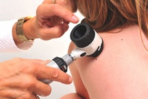 Dấu hiệu ung thư da ở trẻ em