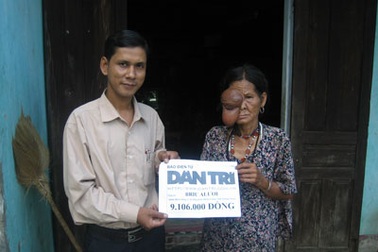 Quà nhân ái đến với “Cụ bà đau đớn với khối u lớn trên mặt”