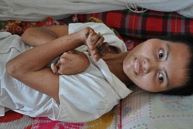 Còn chút sức tàn, cha tật nguyền vẫn chăm con mắc bệnh Wilson hiếm gặp