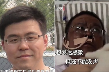 Bác sĩ Trung Quốc bị đổi màu da vì Covid-19 qua đời