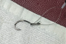 Lưỡi câu dài 4cm mắc trong thực quản cụ ông 83 tuổi