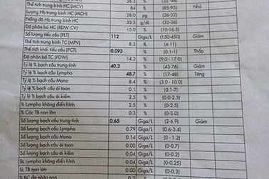 Khi nào cần xét nghiệm theo dõi hạ tiểu cầu, cô đặc máu vì sốt xuất huyết?