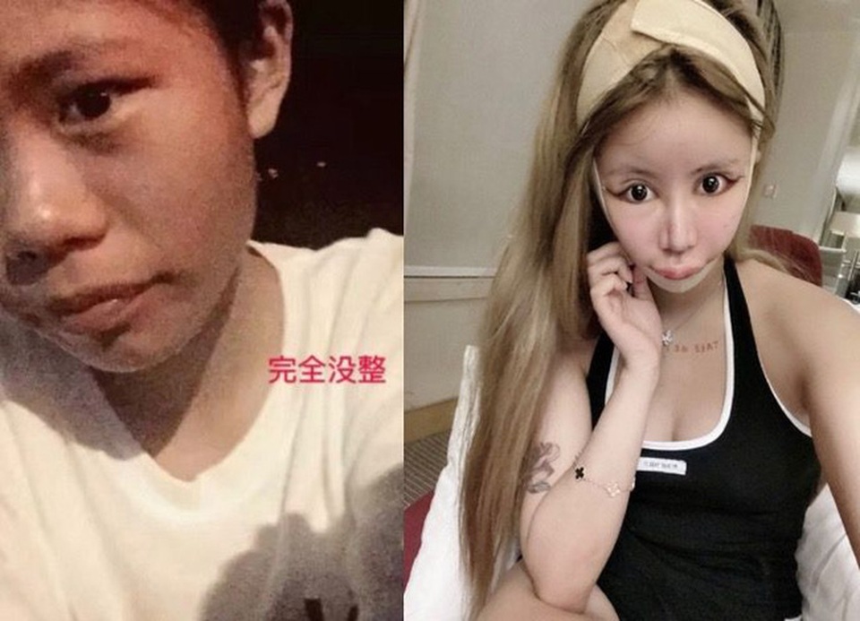 Hoảng sợ trước “gương mặt rắn” của người mẫu 16 tuổi nghiện phẫu thuật - 1 Hoảng sợ trước “gương mặt rắn” của người mẫu 16 tuổi nghiện phẫu thuật - 1