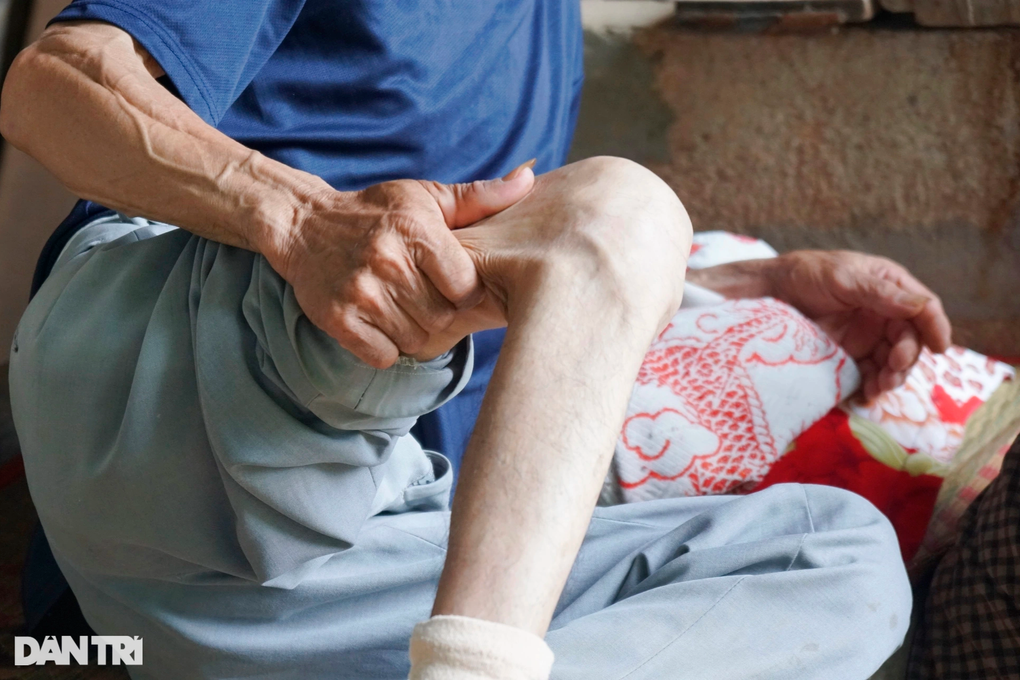 Vợ nghèo bất lực nhìn chồng dần tàn phế vì không tiền chữa trị - 3 Vợ nghèo bất lực nhìn chồng dần tàn phế vì không tiền chữa trị - 3