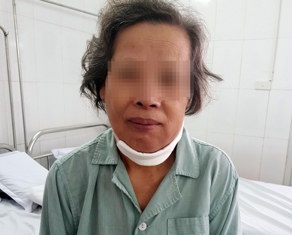 Tưởng viêm họng, sâu răng, người phụ nữ chết lặng vì mắc căn bệnh nguy hiểm - 1 Tưởng viêm họng, sâu răng, người phụ nữ chết lặng vì mắc căn bệnh nguy hiểm - 1