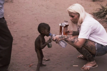 Cuộc sống hiện tại của cậu bé da bọc xương từng khiến cả thế giới ám ảnh