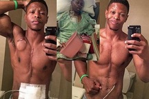 Lực sĩ thể hình sống mà không cần... tim