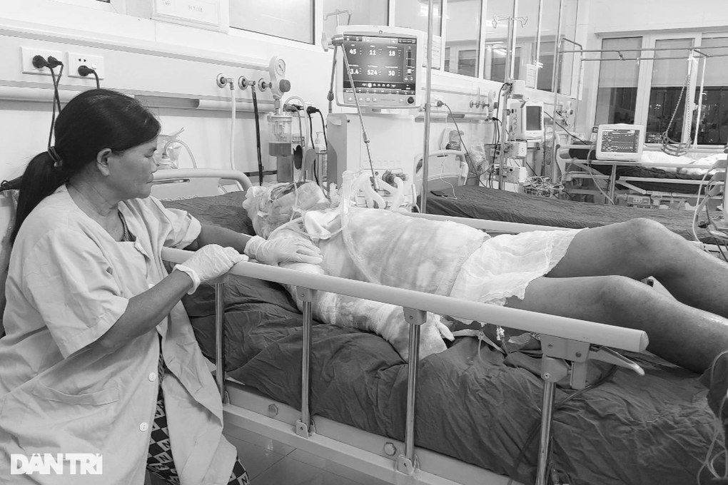 Người đàn ông bị bỏng lửa xăng 43% cơ thể đã qua đời - 1 Người đàn ông bị bỏng lửa xăng 43% cơ thể đã qua đời - 1