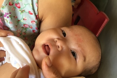 Ánh mắt cầu cứu của bé gái 5 tháng tuổi bị ung thư máu