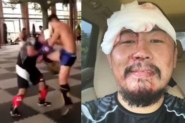 Võ sĩ Từ Hiểu Đông bị đánh “no đòn”, phải khâu 28 mũi