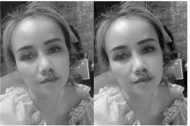 Diễn viên Hoàng Yến tố bị chồng cũ đấm vào mặt, cầm dao đe dọa