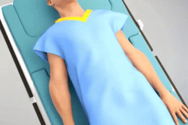 “Mục sở thị” kỹ thuật cấy ghép chân giả cho người tàn tật!