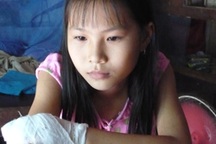 Khởi tố vụ án “bé gái bị cậu chặt cụt tay”