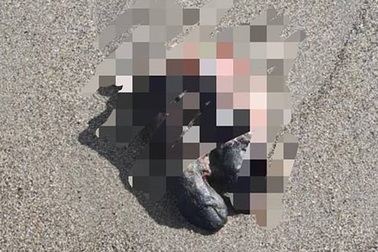 Du khách "đứng tim" khi thấy bàn chân người đang phân huỷ dạt vào bờ biển