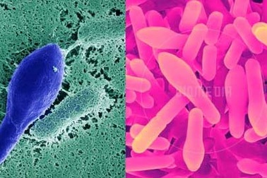 Sự thật đằng sau vụ thu hồi sữa do nghi nhiễm khuẩn độc 