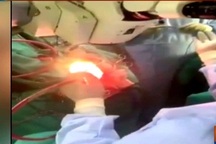 Bệnh nhân Ấn Độ tụng kinh suốt 3 giờ trong ca phẫu thuật cắt bỏ u não