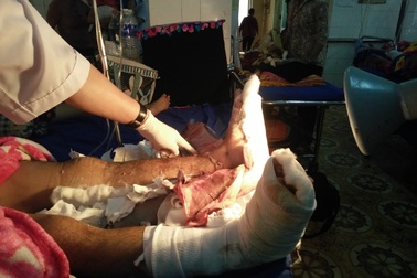 Kinh hoàng nam thanh niên bị côn đồ chém đứt lìa 2 cẳng chân