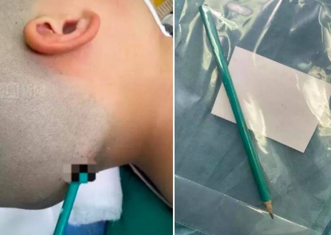 Cáu giận lúc dạy con học bài, người cha ân hận vì suýt làm con mất mạng - 1 Cáu giận lúc dạy con học bài, người cha ân hận vì suýt làm con mất mạng - 1