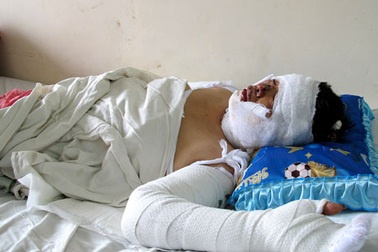 Mâu thuẫn gia đình, chồng tưới xăng đốt vợ