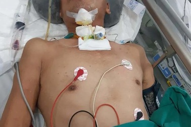 Nỗi đau cùng cực của người đàn bà ung thư bất lực nhìn chồng chấn thương sọ não