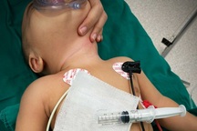 Ăn dặm, bé trai 8 tháng tuổi bị sợi kim loại xuyên thành họng