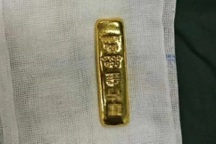 Bé trai nhập viện sau khi nuốt thỏi vàng nặng 2,6 lượng