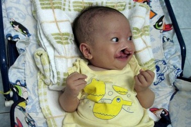 Bé Nhân Nghĩa được kiểm tra tim