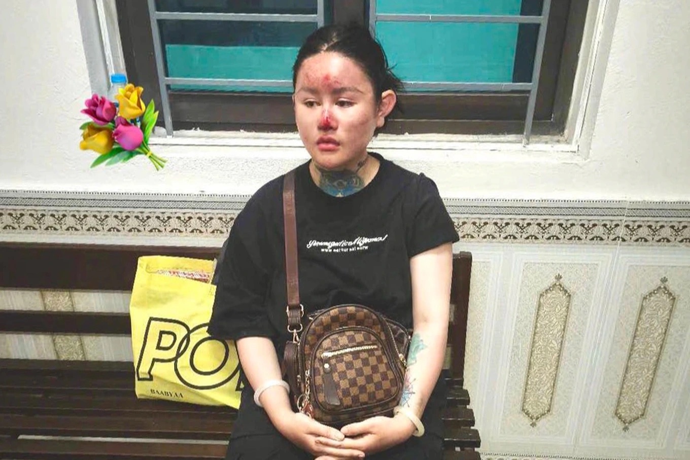 Vệt trượt dài của hot TikToker triệu view Ngân “Baby - 3 Vệt trượt dài của hot TikToker triệu view Ngân “Baby - 3