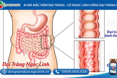 Xua tan nỗi lo viêm đại tràng