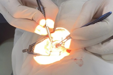 Tỉnh có số người hiến giác mạc nhiều nhất Việt Nam